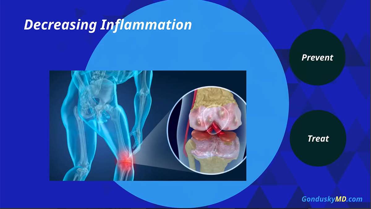 Hip and Knee Arthritis Treatment Options: Learn about medicines, injections and surgery