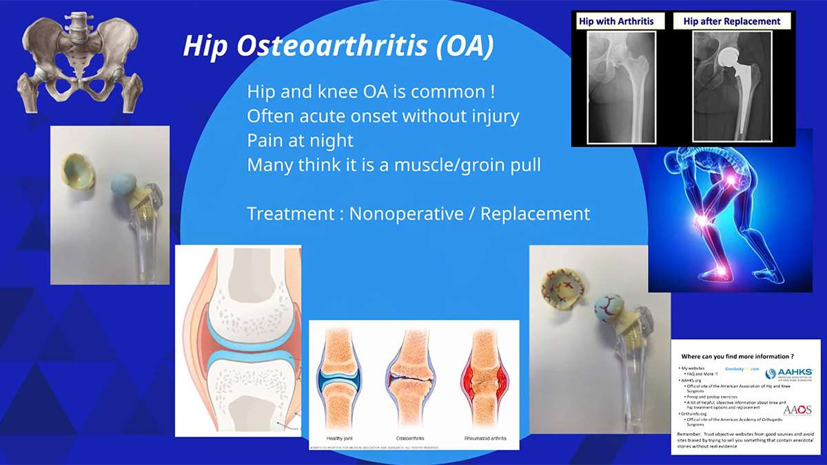 What causes hip pain? Learn about hip bursitis, hip labral tears, and hip arthritis